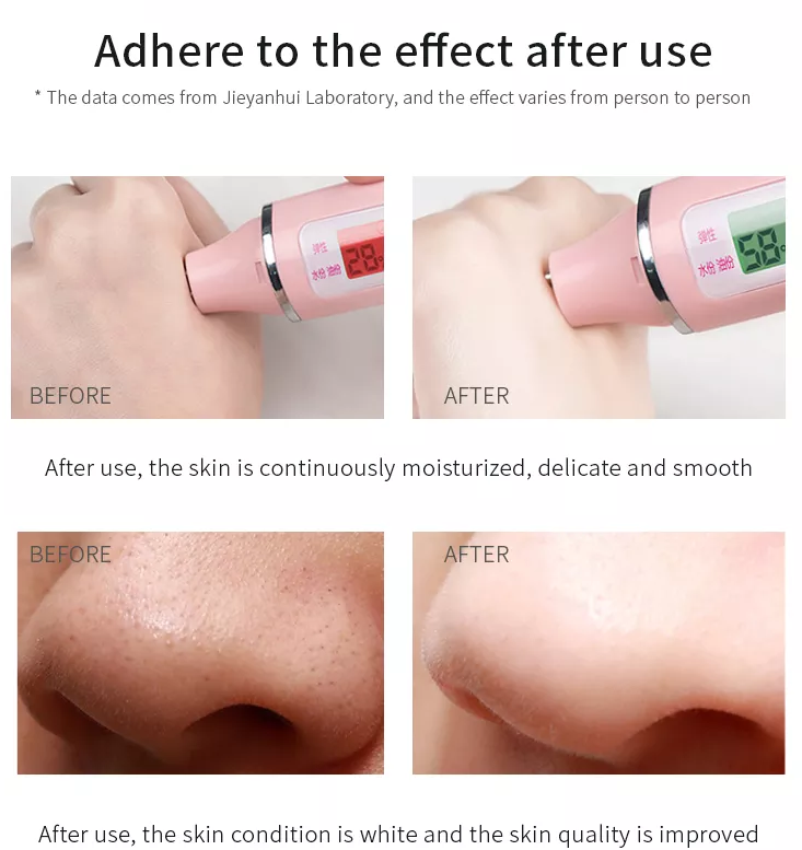 OEM 300G Facial Clay Mask Blackberry Fruit Acid Clay Acne Blackhead Removing