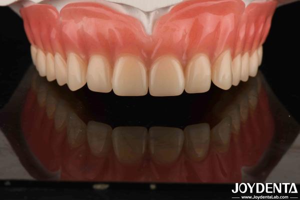 Acrylic Teeth Finish Lightweight Resin Material Dental Restorations Tooth