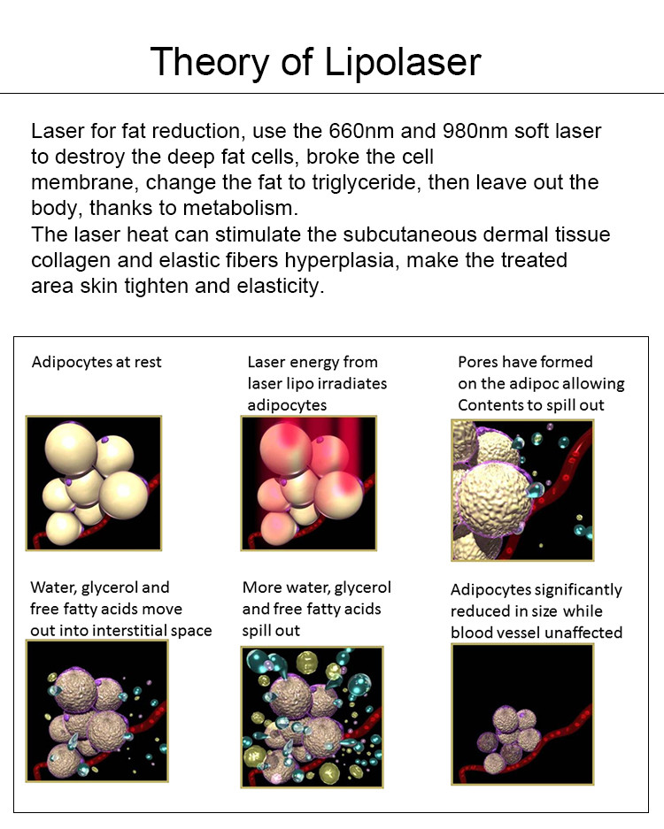 Salon Lipo Laser Slimming Machine 220v For FFat Reduction / Body Shaping