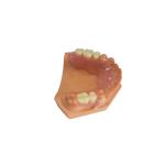 3D Printed Dentures For Dental Labs Based On Digital Data