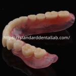 High Esthetics Dental TCS Valplast Flexible Partial Dentures Dental Lab Valplast