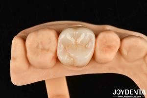 Wholesale High Wear Resistance Dental Full Zirconia High Strength Full Contour Zirconia Bridge from china suppliers