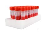 Plastic Nylon Nasal Flocked Swab Oral Buccal Swab Sample Collection Tube