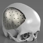 Customized Direct Digital Manufacturing 3D Printing Metal Stainless S136 and