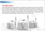Painless safety high frequency 30MHZ spider vein removal and varicose vein
