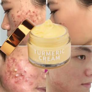 Wholesale Organic Skin Care Acne Wrinkle Dark Spot Moisturizer Bleaching Turmeric Face Cream from china suppliers