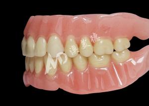 Wholesale Affordable Full Arch Acrylic Dentures for Comfortable Removable Dentures from china suppliers