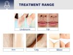 Guangzhou DPL Beauty Machine Factory Supply 60 million times shot Diode Laser