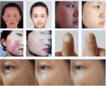 Beauty Salon 980nm Diode Laser Machine For Pain Relief / Vascular Treatment