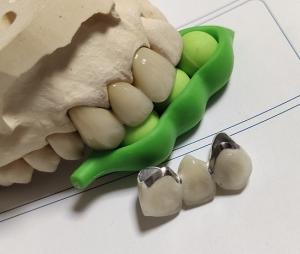 Wholesale Porcelain CAD CAM PFM Crown from china suppliers