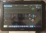 1920x1080 Smart Health Patient Monitor Repair 110V-240V Voltage