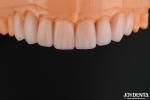 Customizable Glass Ceramic Veneer Natural Looking High Chemical Resistance