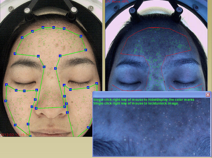 Visia Skin Scanner Analysis Machine , Digital Camera Portable Skin Analyzer