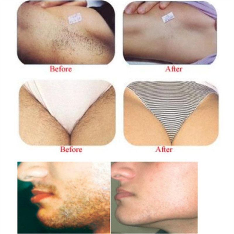 Home Use Ipl 610nm Laser Hair Removal Machine Permanent Skin Rejuvenation