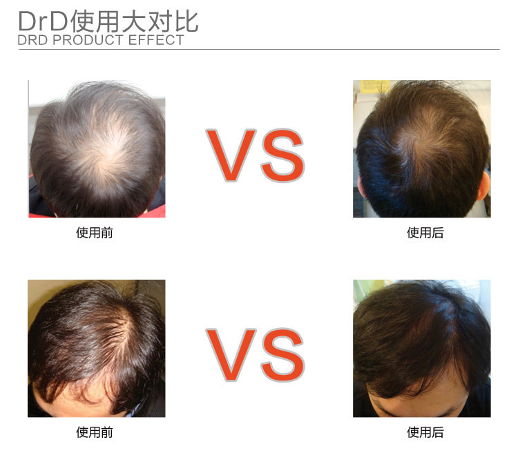 hair treatment Hair Growth Essence anti hair Loss Liquid dense unix hair conditioner Serum