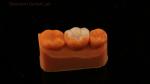 Strength Emax Ceramic Crown Dental Onlay with Excellent Stain Resistance China