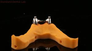 Wholesale Ivoclar Digital Dental Implant Bar Denture with Attachments , Full Acrylic Titanium Implant Supported Dentures from china suppliers