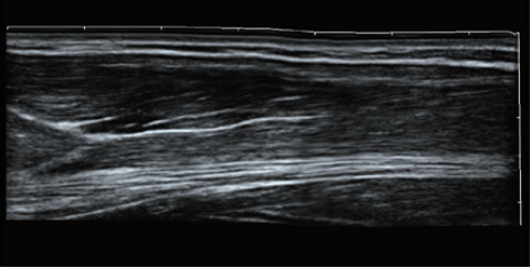 New design cardiac and 4d function Sonoscape P15 ultrasound for hospital