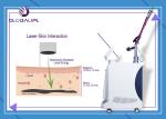 Q- Switch ND YAG Laser Machine Color Tattoo Removal 1064nm 532nm