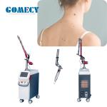 Q Switched Nd Yag Laser Body Machine Laser Skin Treatment Machine Eyebrow Tattoo