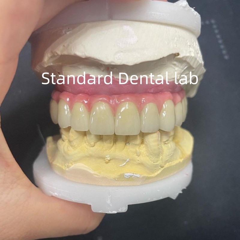 Malo Bridge Hybrid Zirconia All On Four / Six Zirconia Implant Bridge TItanium Bar