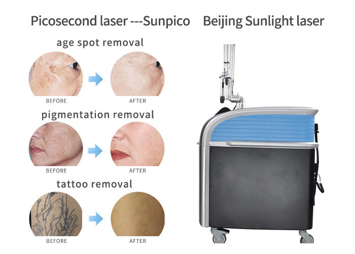 1064nm Laser Tattoo Removal Device , Picosure Fractional Tattoo Eraser Machine