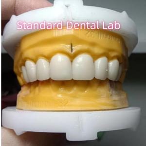 Wholesale Ivoclar Zirconia Crown Veneers High Translucency Esthetic from china suppliers