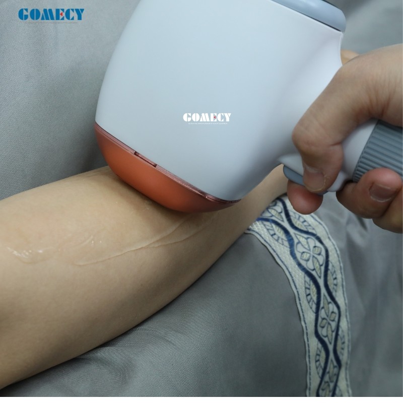 755 808 1064nm OEM Diode Laser Hair Removal Device for Ozero Khanka Pioneer
