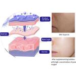 Skin Tightening Wrinkle Removal 100v Multifunction Beauty Machine For Salon