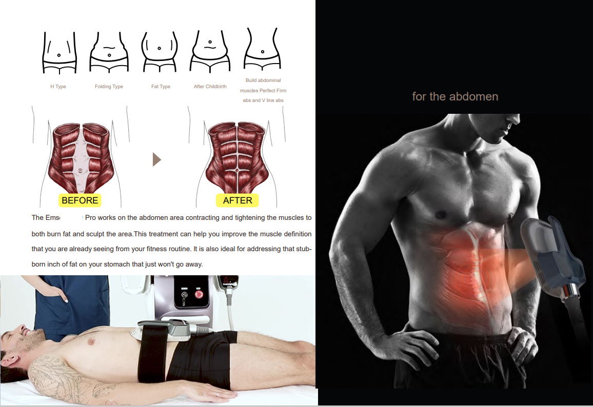 600w 5 Handles EMS Sculpting Machine For Neo RF 14 Tesla Bodi Sculpting Body Slimming