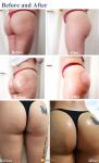 Female Electric Beautiful Enhancer Boobs Care Hot Big Breast Enlargement Machine