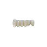OEM Implant Zirconia Dental Crown Fixed Bridge