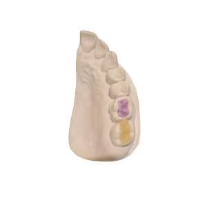 Wholesale Custom High-Density Custom Dental Ceramics FDA All-Ceramic Crown from china suppliers
