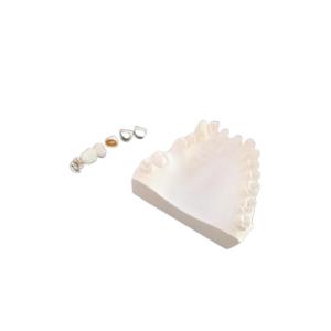 Wholesale Customized PFM Porcelain Dental Crown Full Metal Corrosion Resistance from china suppliers