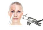Stationary Vaginal Tightening Co2 Fractional Laser Machine 10600nm