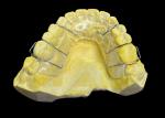 Three Direction Removable Orthodontic Appliances For Customer Requirements At
