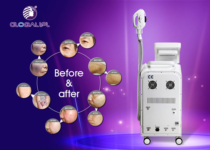 E Light / IPL RF ND YAG Laser Hair / Tattoo Removal Multifunctional Beauty Machiine 2500W Power
