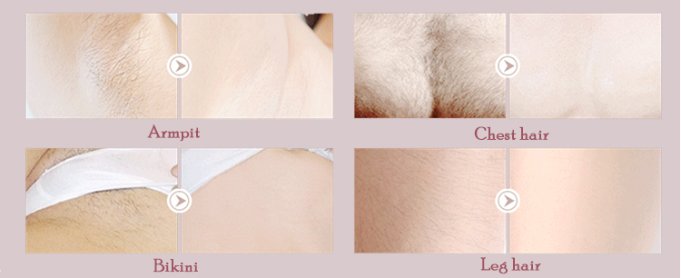 Electric Depilator Hair Removal Machine , Epilator Hairy Removal Beauty Machine