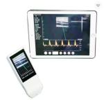Medical Wifi Ultrasound Machine Android Portable Wireless Ultrasound Probe