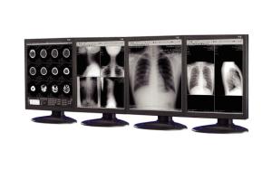 Wholesale Anti-reflective Medical Grade Displays used in medical imaging equipment from china suppliers