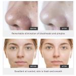 OEM ODM Mud Mask Facial Care Blackheads Acne Gently Clean Pore Volcanic Mud