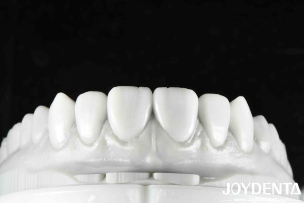 Revolutionize Your Dental Practice with Natural Tooth Morphology Tooth