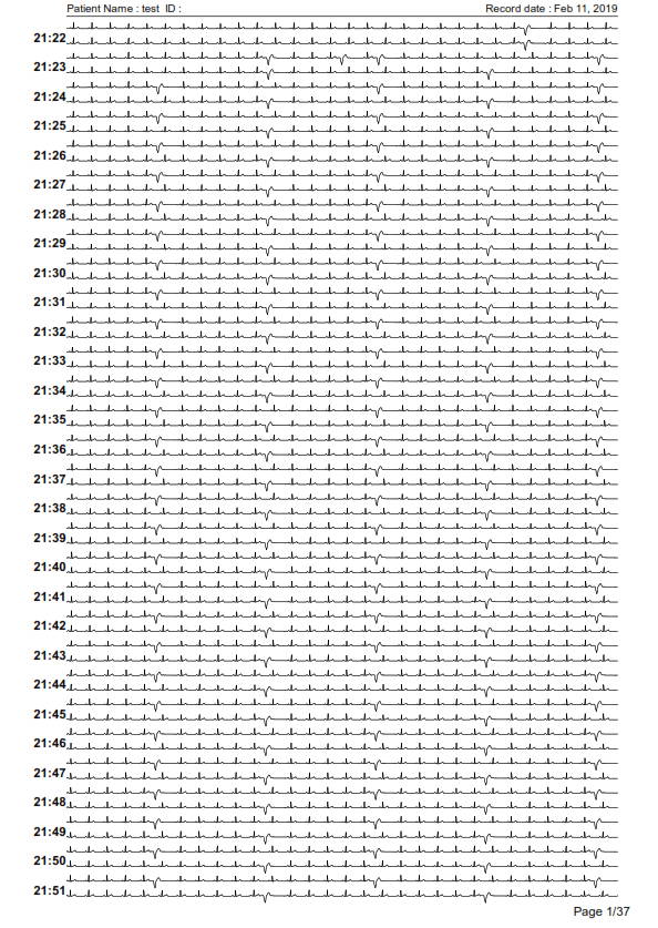 ecg report