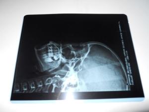 Wholesale KND-A Konida High Sharpness Medical Dry Imaging Film For Thermal Printer from china suppliers