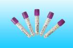 Sterile Vacuum EDTA Tube With Stopper Purple Top vacuum blood colletion tube