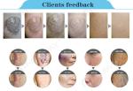Promotion！laser skin clinic ND:Yag Laser Tattoo Removal/Skin Rejuvenation Unit
