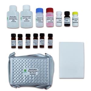 Wholesale Deoxynivalenol Medical Diagnostic ELISA Kits 2ppb For Feed 96 Wells/Kit Sensitivity from china suppliers