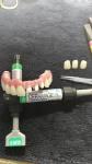 Flexible Individual Titanium Removable Dental Crown For Dental Clinic
