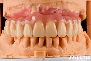 Wholesale Comfortable Wear Acrylic Denture Finished With Tooth Arrangement Technology from china suppliers