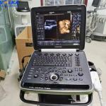 Samsung Medison 4D Original Ultrasound System HM70A